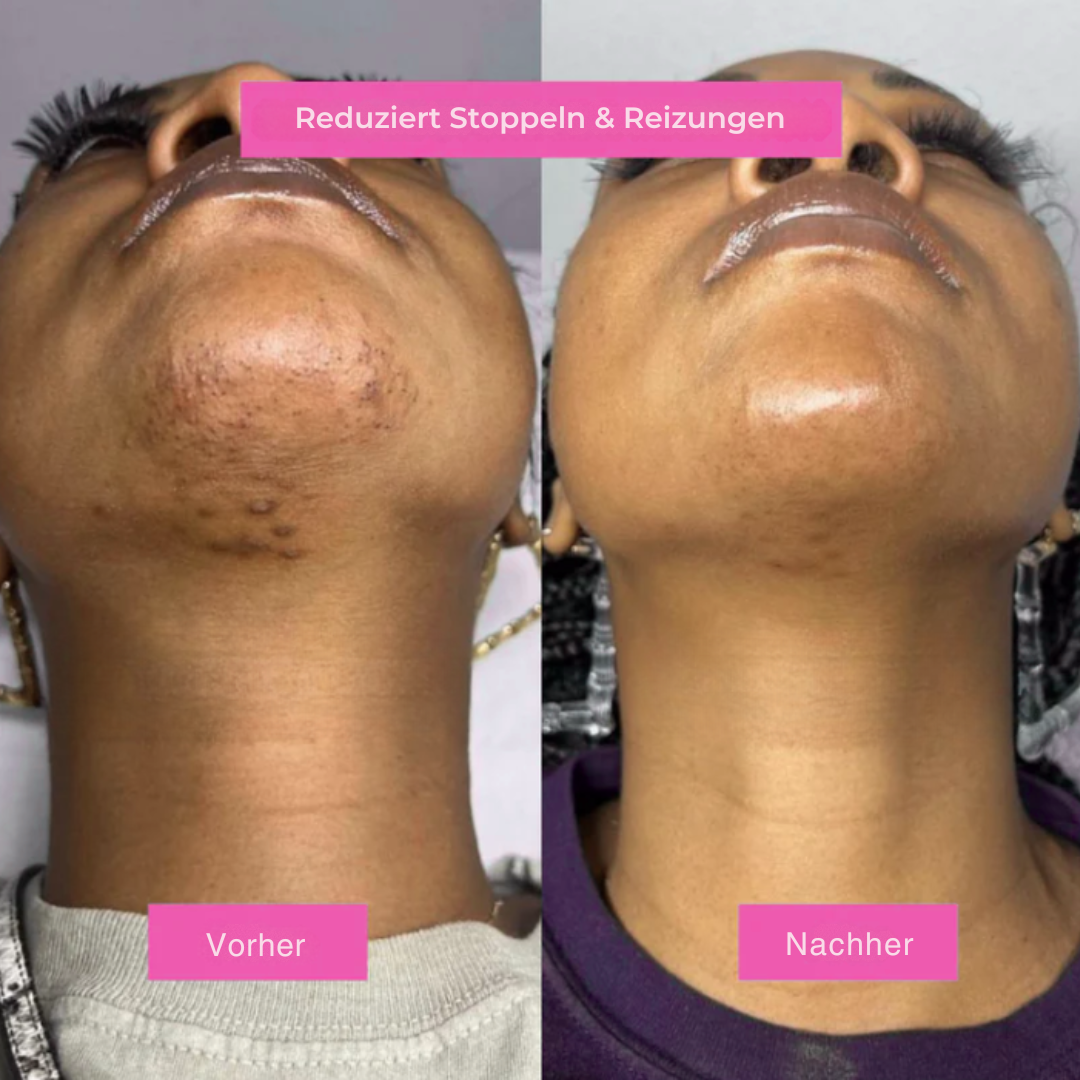 Haarentfernungsöl – Natürlich glatte Haut ohne Rasierer